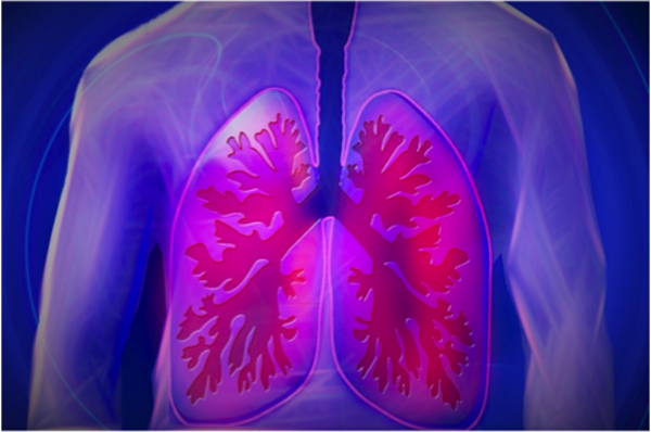 Tumore del polmone: come limitare la dose sul cuore