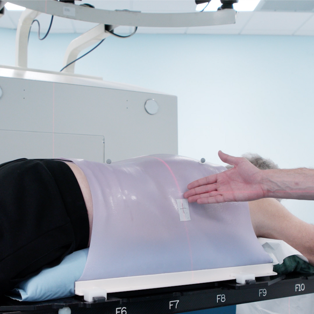 CNAO PRESENTS PATIENT'S COURSE THORACO-ABDOMINAL AND PELVIC DISTRICT PATHOLOGIES